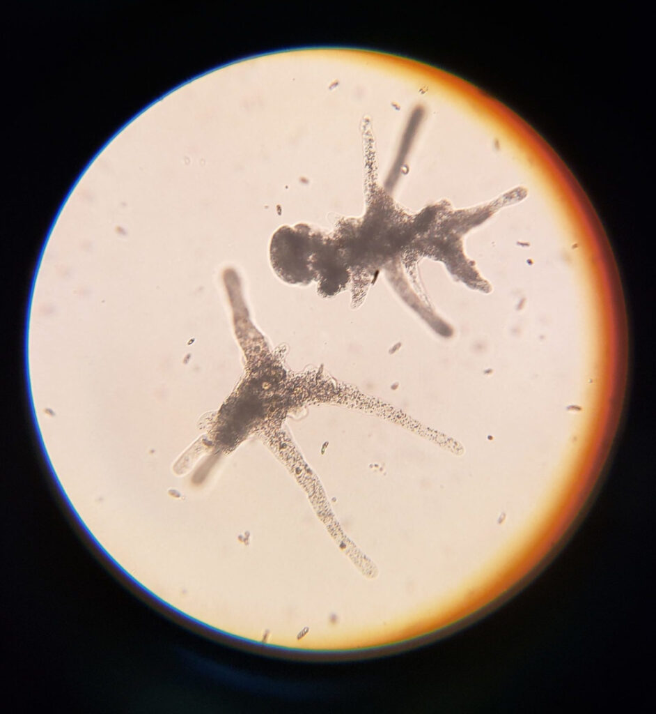 Amoeba Proteus di bawah Microscope